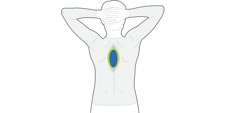 The Backpod